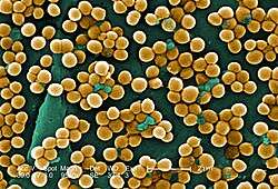 Colorized micrograph: sphere-shaped bacteria clustered in grape-like bunches.