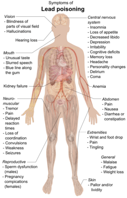A chart of a human body with arrows pointing pieces of text to different parts of the body